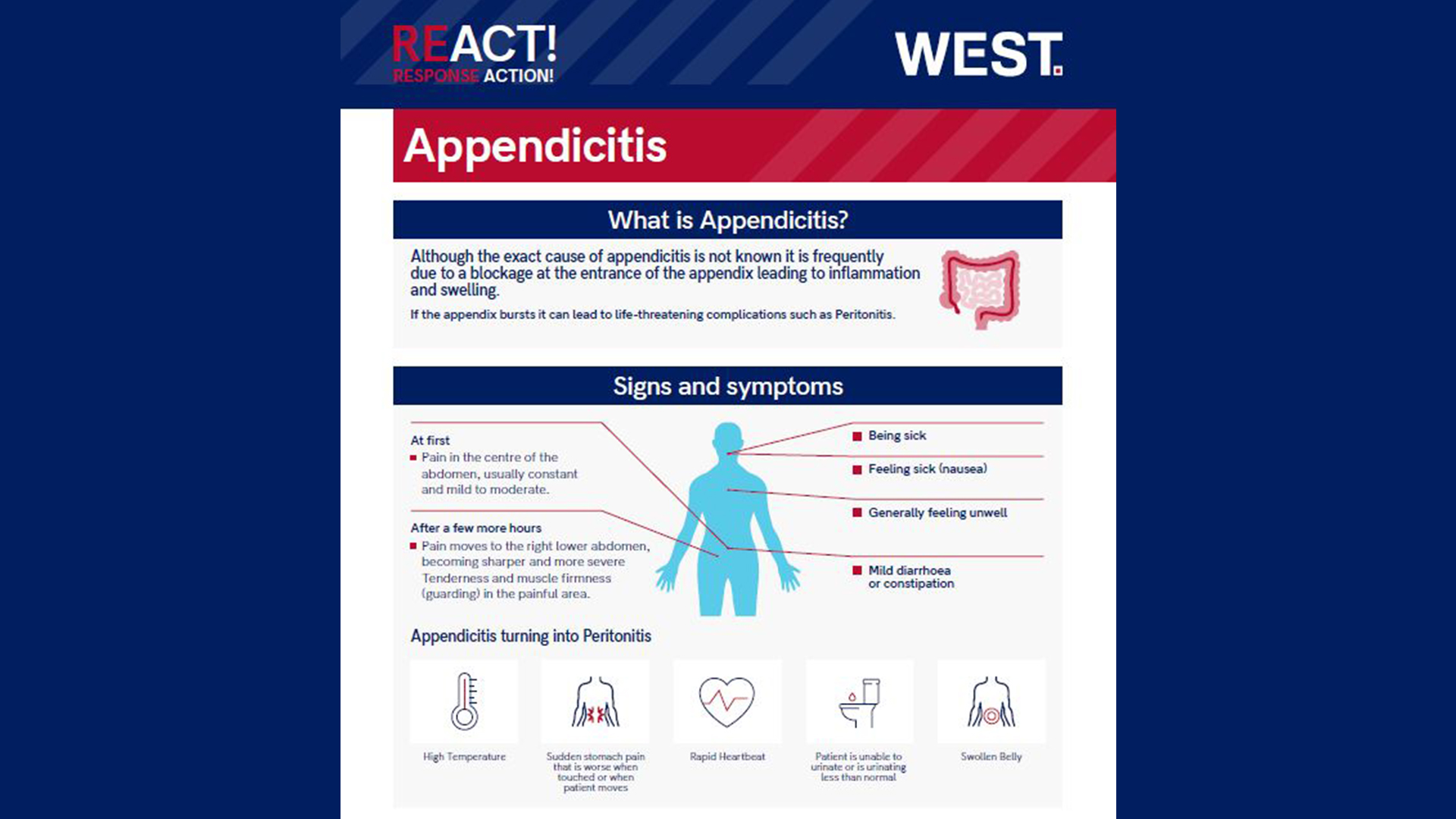 New REACT! Loss Prevention Poster Published on Appendicitis